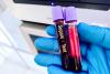 Memorial Hospital’s sepsis program is making waves