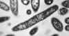 Second death reported in Legionnaires’ disease outbreak in New York City