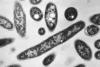 2nd Person in NYC Dies During Legionnaires’ Disease Outbreak