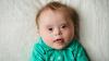 ‘Ensure timely screening and care for Down syndrome’