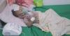 Rising measles cases strain Yemen's hospitals, leaving young patients, families in desperate struggle
