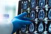 Scientists reveal protein that could reverse damage from Alzheimer’s disease
