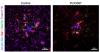 Two Hours of Sleep Restored: UK Researchers Make Alzheimer's Breakthrough