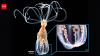Scientists found an anemone that can distinguish helpful bacteria from harmful bacteria without...