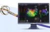 Boston Scientific enrolls first patient in FARADIGM IDE trial for Faraflex PFA system