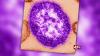 Delaware Confirms First Positive Measles Case in Over a Decade