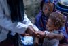 Experts warn of health risks amid measles resurgence
