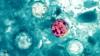 ADPH reports 28 cases of cyclosporiasis in Alabama as of July 20
