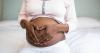 Jamaica’s maternal mortality ratio 150.3 per 100,000 live births in 2024, says PIOJ