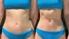 The no-diet, no-exercise slimming hack as nurse claims she dropped ‘6lb instantly’ – so what’s the expert verdict?