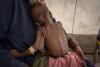Africa becomes the global epicenter of hunger for the first time