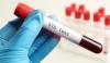557 new STI infections reported in first half of 2026