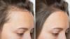 Can Keranique regrow hair? What the science says about its key ingredients