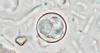 As cyclospora infections climb in Missouri, we answer your questions about the parasitic illness