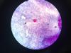 Kennedy Says Cyclospora Threat Is Contained as Case Reports Continue Climbing