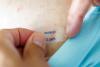 Rome hospital fentanyl theft pushes Italy to tighten opioid security