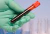 Scientific community brought Trump’s funding threat on itself