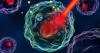 Researchers Clear Two Major Hurdles for Minimally Invasive Cancer Therapy