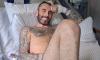 Doctors thought 35 year-old's eating problems were caused by a hernia. It was horrific 'leather stomach' cancer that's spread 'everywhere'