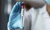 Over 1,000 deaths recorded in Ebola outbreak in DRC, Uganda: WHO