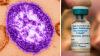 Texas DSHS issues health alert after 4 measles cases reported in Montgomery County