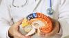 Health experts call for European neurological strategy