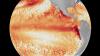 A ‘super’ El Niño appears to be emerging. What’s the big deal?