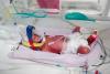 Australian woman gives birth to rare identical quadruplets conceived naturally