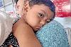 Measles Outbreak Continues in Bangladesh with 6 More Deaths, Total Toll Reaches 803