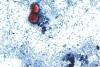 Officials look into produce linked to US outbreak