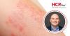 Q&A: How Is Precision Medicine Changing Atopic Dermatitis Care? With Jason Hawkes, MD