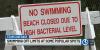 Bacteria levels close Rocky Neck and other Connecticut swimming areas after storms