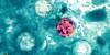 Missouri cyclosporiasis cases double in one week to over 1,000