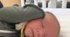 Infant injured in bonfire accident to receive free medical care thanks to Shriners