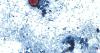 CU scientific review finds climate change makes it harder to control diseases like cyclosporiasis
