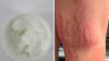 HSA warns against 3 products after consumers, including a 12-year-old, suffer serious health effects