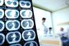 Health care paradox: Korea achieves world-class longevity with fewest doctors among developed nations