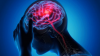 About 470 million people in Americas have neurological disorders: WHO Report