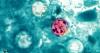 New Cyclospora Outbreak Explained: FDA Investigates 72 Cases With No Food Source Identified Yet
