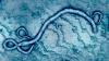 Rapid Review Quiz: 2026 Ebola Outbreak Update