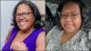 The fight against sarcoma: Black patients push for earlier detection and better research