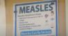 Alabama Department of Public Health: Out-of-state Alabamian's measles diagnosis a reminder of vaccine's importance
