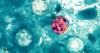 Covering Your Health: Cyclospora cases rising in Louisiana, with Lafayette leading state