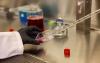 Indiana University Student Researchers Pursue New Treatment for Often-Misdiagnosed Form of Hydrocephalus