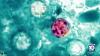 Cases of diarrhea-causing parasite rise in Florida, with Miami-Dade leading in confirmed cases