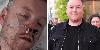ITV Britain’s Got Talent finalist, 31, placed into induced coma after mystery health battle