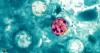 Hundreds of potential cases of cyclosporiasis investigated in North Carolina