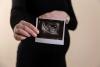 A mix of air pollutants in early pregnancy linked to risk of premature birth