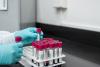 Can The Effects Of Aging Be Reversed? Scientists Believe They May Have Taken A Step Toward Doing So