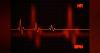 Researchers Create Detailed Map of Gene Regulation Breakdowns in Heart Failure